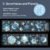 2. Snowflakes and Planets